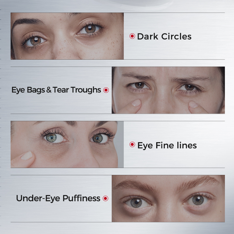 Parches para Ojos para Ojeras  - Collagen Eye Patch reseña y precio